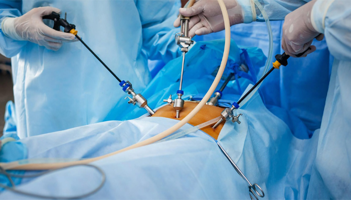 Cirugía Mínimamente Invasiva